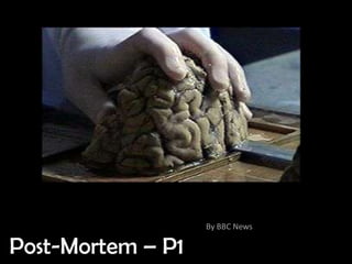 By BBC News

Post-Mortem – P1
 