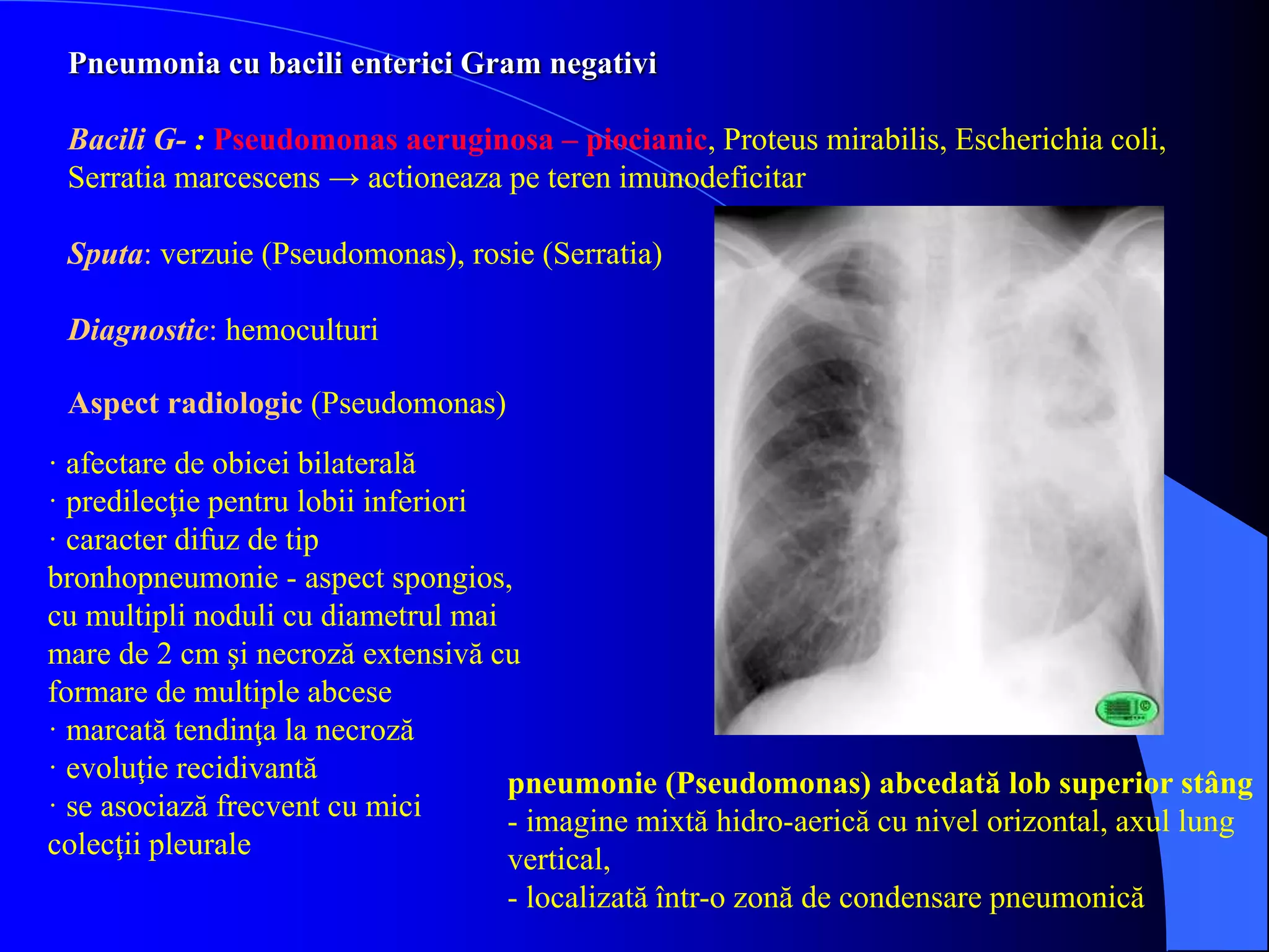 Pneumonia cu bacili enterici Gram negativi
Bacili G- : Pseudomonas aeruginosa – piocianic, Proteus mirabilis, Escherichia coli,
Serratia marcescens → actioneaza pe teren imunodeficitar
Sputa: verzuie (Pseudomonas), rosie (Serratia)
Diagnostic: hemoculturi
pneumonie (Pseudomonas) abcedată lob superior stâng
- imagine mixtă hidro-aerică cu nivel orizontal, axul lung
vertical,
- localizată într-o zonă de condensare pneumonică
· afectare de obicei bilaterală
· predilecţie pentru lobii inferiori
· caracter difuz de tip
bronhopneumonie - aspect spongios,
cu multipli noduli cu diametrul mai
mare de 2 cm şi necroză extensivă cu
formare de multiple abcese
· marcată tendinţa la necroză
· evoluţie recidivantă
· se asociază frecvent cu mici
colecţii pleurale
Aspect radiologic (Pseudomonas)
 
