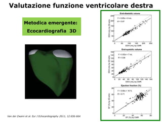 Van der Zwann et al. Eur J Echocardiography 2011; 12:656-664
Valutazione funzione ventricolare destra
Metodica emergente:
Ecocardiografia 3D
 
