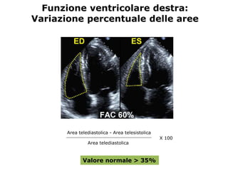 Funzione ventricolare destra:
Variazione percentuale delle aree
Area telediastolica - Area telesistolica
Area telediastolica
X 100
Valore normale > 35%
 