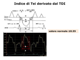 b
a
Indice di Tei derivato dal TDI
valore normale ≤0.55
 