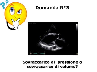 Domanda N°3
Sovraccarico di pressione o
sovraccarico di volume?
 