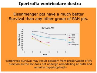Eisenmenger pts have a much better
Survival than any other group of PAH pts.
<Improved survival may result possibly from preservation of RV
function as the RV does not undergo remodelling at birth and
remains hypertrophied>
Ipertrofia ventricolare destra
 