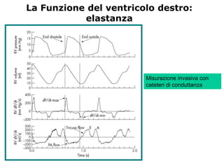 La Funzione del ventricolo destro:
elastanza
Misurazione invasiva con
cateteri di conduttanza
 