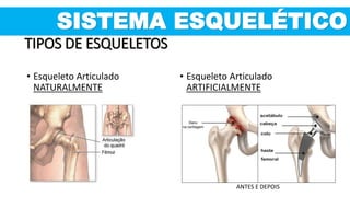 SISTEMA ESQUELÉTICO
TIPOS DE ESQUELETOS
• Esqueleto Articulado
ARTIFICIALMENTE
• Esqueleto Articulado
NATURALMENTE
ANTES E DEPOIS
 