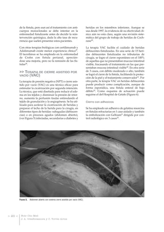 de la fístula, pero aun así el tratamiento con anti-                       heridas en los miembros inferiores. Aunque se
         cuerpos monoclonales se debe intentar en la                                usa desde 1997, la evidencia de su efectividad clí-
         enfermedad fistulizante antes de decidir la rein-                          nica aún no esta clara, según una revisión siste-
         tervención quirúrgica, dada la alta tasa de recu-                          mática del grupo de trabajo de heridas de Coch-
         rrencia que suelen presentar estos pacientes.                              rane29.

         Con otras terapias biológicas con certilimumab y                           La terapia VAC facilita el cuidado de heridas
         Adalimumab existe menor experiencia clínica27.                             dehiscentes fistulizadas. En una serie de 15 heri-
         El tacrolimus se ha empleado en la enfermedad                              das dehiscentes fistulizadas no tributarias de
         de Crohn con fístula perianal, aprecián-                                   cirugía, se logro el cierre espontáneo en el 100%
         dose una mejoría, pero no la remisión de las fís-                          de aquellas que no presentaban mucosa intestinal
         tulas28.                                                                   visible, fracasando el tratamiento en las que pre-
                                                                                    sentaban mucosa intestinal visible30. En otra serie
         >> TERAPIA DE CIERRE ASISTIDO POR                                          de 3 casos, con débito moderado o alto, también
         VACÍO (VAC)                                                                se logró el cierre de la fístula, facilitando la protec-
                                                                                    ción de la piel y el tratamiento conservador31. Por
         La terapia de presión negativa (NPT) o cierre asis-                        otra parte, la terapia VAC en heridas dehiscentes
         tido por vacío (VAC) es una técnica eficaz para                            puede producir como complicación, aunque de
         estimular la cicatrización por segunda intención.                          forma esporádica, una fístula enteral de bajo
         La técnica, que está diseñada para reducir el ede-                         débito32. Como esquema de actuación puede
         ma en los tejidos y disminuir la presión de retor-                         seguirse el del Hospital de Getafe (Figura 6).
         no, aumenta la perfusión tisular estimulando el
         tejido de granulación y la angiogénesis. Se ha uti-                        Cierre con adhesivos
         lizado para acelerar la cicatrización de heridas y
         preparar el lecho de la herida para la cirugía, en                         Se ha empleado un adhesivo de gelatina resorcina
         diferentes tipos de heridas: subagudas (dehiscen-                          en fístulas refractarias en 1 caso aislado y también
         cias) o en procesos agudos (abdomen abierto),                              la embolización con Gelfoam® dirigida por con-
         (ver Figura 5) infectadas, secundarias a diabetes y                        trol radiológico en 3 casos33.




         FIGURA 5.   Abdomen abierto con sistema cierre asistido por vacío (VAC).




> 20 <    Nutr Clin Med
          J. A. IrlesRocamora y C. Torres Arcos
 