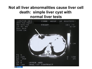 02.01.12(b): Liver Tests - Use and Interpretation | PPT