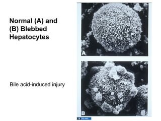 02.01.12(b): Liver Tests - Use and Interpretation | PPT