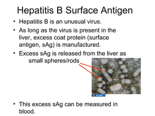 Hepatitis B Surface Antigen
• Hepatitis B is an unusual virus.
• As long as the virus is present in the
  liver, excess coat protein (surface
  antigen, sAg) is manufactured.
• Excess sAg is released from the liver as
      small spheres/rods




• This excess sAg can be measured in
  blood.
 