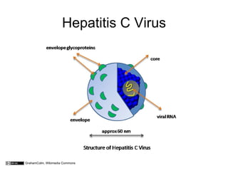 Hepatitis C Virus




GrahamColm, Wikimedia Commons
 
