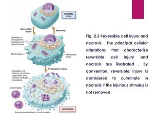 02&03&04_Adaptation ,Cell Injury & Death.pdf