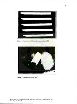 Dewi Vindani : Cairan Sulkus Gingiva Dan Peranannya Dalam Bidang Kedokteran Gigi, 2007.
USU e-Repository © 2008
 