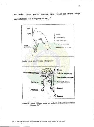 Dewi Vindani : Cairan Sulkus Gingiva Dan Peranannya Dalam Bidang Kedokteran Gigi, 2007.
USU e-Repository © 2008
 