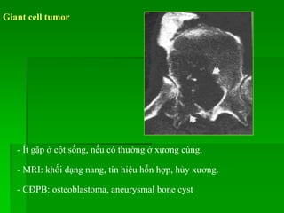 Giant cell tumor
- Ít gặp ở cột sống, nếu có thường ở xương cùng.
- MRI: khối dạng nang, tín hiệu hỗn hợp, hủy xương.
- CĐPB: osteoblastoma, aneurysmal bone cyst
 