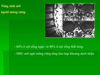 Tăng sinh mỡ
ngoài màng cứng
- 60% ở cột sống ngực và 40% ở cột sống thắt lưng.
- MRI: mỡ ngài màng cứng tăng làm hẹp khoang dưới nhện
 