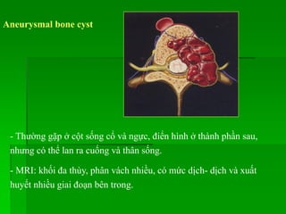 Aneurysmal bone cyst
- Thường gặp ở cột sống cổ và ngực, điển hình ở thành phần sau,
nhưng có thể lan ra cuống và thân sống.
- MRI: khối đa thùy, phân vách nhiều, có mức dịch- dịch và xuất
huyết nhiều giai đoạn bên trong.
 