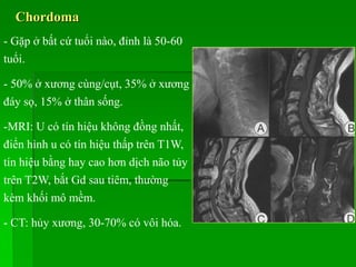Chordoma
- Gặp ở bất cứ tuổi nào, đỉnh là 50-60
tuổi.
- 50% ở xương cùng/cụt, 35% ở xương
đáy sọ, 15% ở thân sống.
-MRI: U có tín hiệu không đồng nhất,
điển hình u có tín hiệu thấp trên T1W,
tín hiệu bằng hay cao hơn dịch não tủy
trên T2W, bắt Gd sau tiêm, thường
kèm khối mô mềm.
- CT: hủy xương, 30-70% có vôi hóa.
 