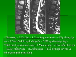 1.Thân sống – 2.Đĩa đệm – 3.Dây chằng dọc trước – 4.Dây chằng dọc
sau – 5.Đám rối tĩnh mạch sống-nền – 6.Mỡ ngoài màng cứng –
7.Tĩnh mạch ngoài màng cứng – 8.Mỏm ngang – 9.Dây chằng liên gai
– 10.Dây chằng vàng – 11.Cuống sống – 12.Lỗ liên hợp với mỡ và
tĩnh mạch ngoài màng cứng
 