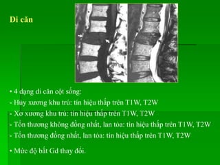 Di căn
• 4 dạng di căn cột sống:
- Hủy xương khu trú: tín hiệu thấp trên T1W, T2W
- Xơ xương khu trú: tín hiệu thấp trên T1W, T2W
- Tổn thương không đồng nhất, lan tỏa: tín hiệu thấp trên T1W, T2W
- Tổn thương đồng nhất, lan tỏa: tín hiệu thấp trên T1W, T2W
• Mức độ bắt Gd thay đổi.
 