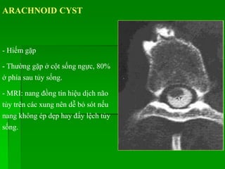 ARACHNOID CYST
- Hiếm gặp
- Thường gặp ở cột sống ngực, 80%
ở phía sau tủy sống.
- MRI: nang đồng tín hiệu dịch não
tủy trên các xung nên dễ bỏ sót nếu
nang không ép dẹp hay đẩy lệch tủy
sống.
 