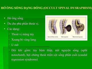 HỞ ỐNG SỐNG DẠNG ĐÓNG (OCCULT SPINAL DYSRAPHISM)
 Hở ống sống
 Da che phủ phần thoát vị.
 Các dạng:
 Thoát vị màng tủy
 Xoang bì vùng lưng
 U mỡ
 Đôi khi gồm: tủy bám thấp, nứt nguyên sống (split
notochord), hội chứng thoái triển cột sống phần cuối (caudal
regression syndroms)
 