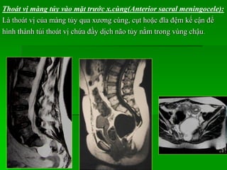 Thoát vị màng tủy vào mặt trước x.cùng(Anterior sacral meningocele):
Là thoát vị của màng tủy qua xương cùng, cụt hoặc đĩa đệm kế cận để
hình thành túi thoát vị chứa đầy dịch não tủy nằm trong vùng chậu.
 