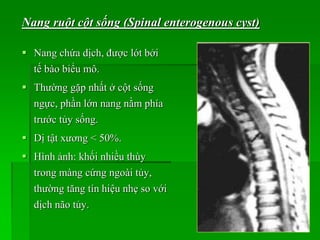  Nang chứa dịch, được lót bởi
tế bào biểu mô.
 Thường gặp nhất ở cột sống
ngực, phần lớn nang nằm phía
trước tủy sống.
 Dị tật xương < 50%.
 Hình ảnh: khối nhiều thùy
trong màng cứng ngoài tủy,
thường tăng tín hiệu nhẹ so với
dịch não tủy.
Nang ruột cột sống (Spinal enterogenous cyst)
 