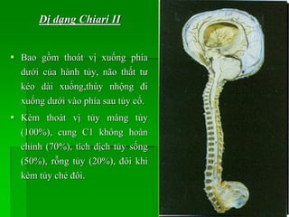 Bao gồm thoát vị xuống phía
dưới của hành tủy, não thất tư
kéo dài xuống,thùy nhộng đi
xuống dưới vào phía sau tủy cổ.
 Kèm thoát vị tủy màng tủy
(100%), cung C1 không hoàn
chỉnh (70%), tích dịch tủy sống
(50%), rỗng tủy (20%), đôi khi
kèm tủy chẻ đôi.
Dị dạng Chiari II
 