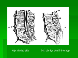 Mặt cắt dọc giữa Mặt cắt dọc qua lỗ liên hợp
 