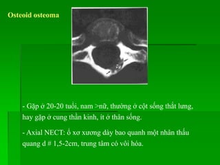 - Gặp ở 20-20 tuổi, nam >nữ, thường ở cột sống thắt lưng,
hay gặp ở cung thần kinh, ít ở thân sống.
- Axial NECT: ổ xơ xương dày bao quanh một nhân thấu
quang d # 1,5-2cm, trung tâm có vôi hóa.
Osteoid osteoma
 