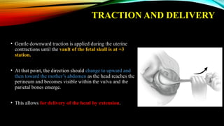 Operative Vaginal Delivery Dr NNC Unit Seminar.pptx