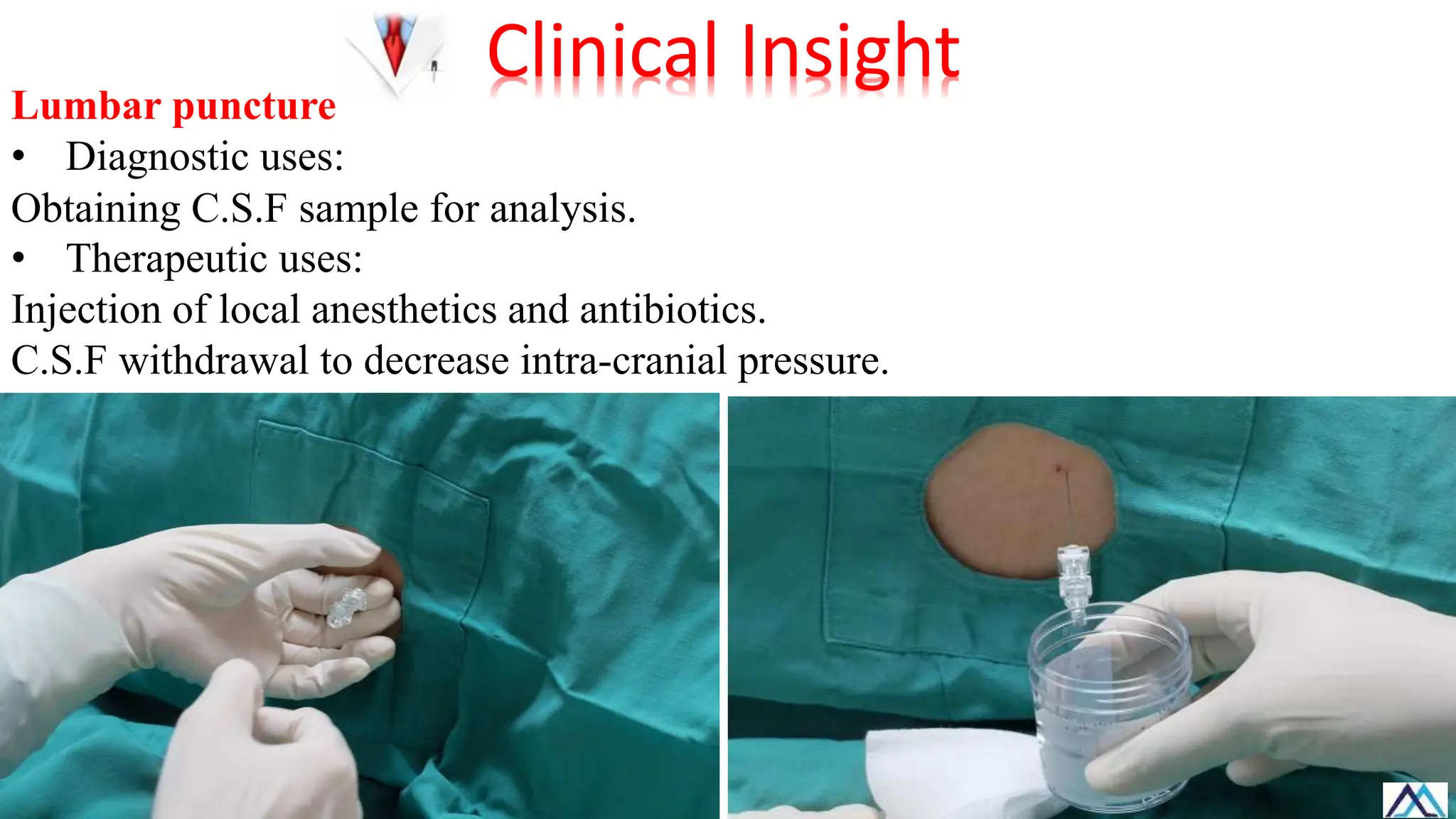 Lumbar puncture
• Diagnostic uses:
Obtaining C.S.F sample for analysis.
• Therapeutic uses:
Injection of local anesthetics and antibiotics.
C.S.F withdrawal to decrease intra-cranial pressure.
Clinical Insight
 