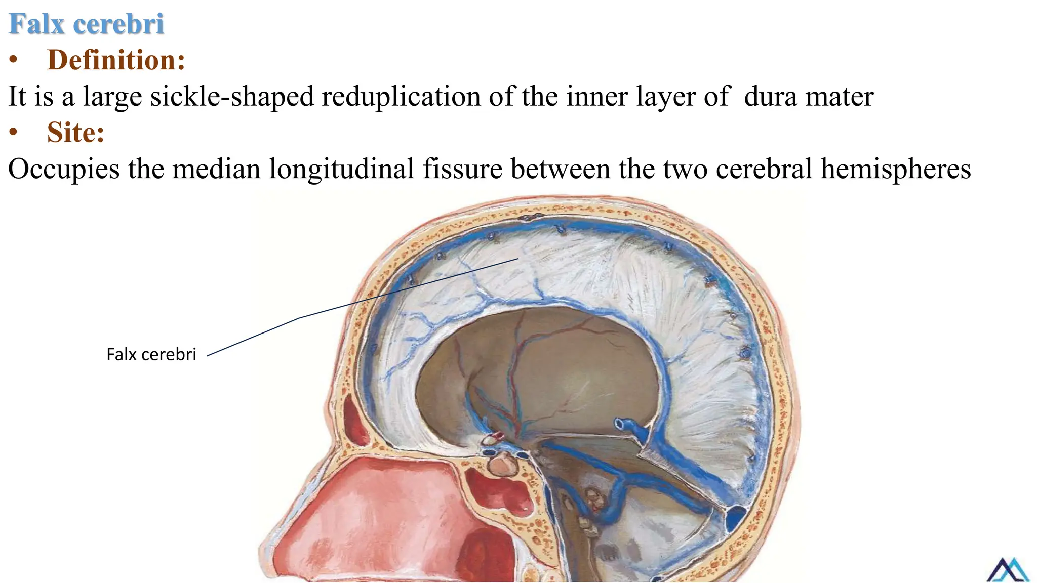 Falx cerebri
• Definition:
It is a large sickle-shaped reduplication of the inner layer of dura mater
• Site:
Occupies the median longitudinal fissure between the two cerebral hemispheres
Falx cerebri
 