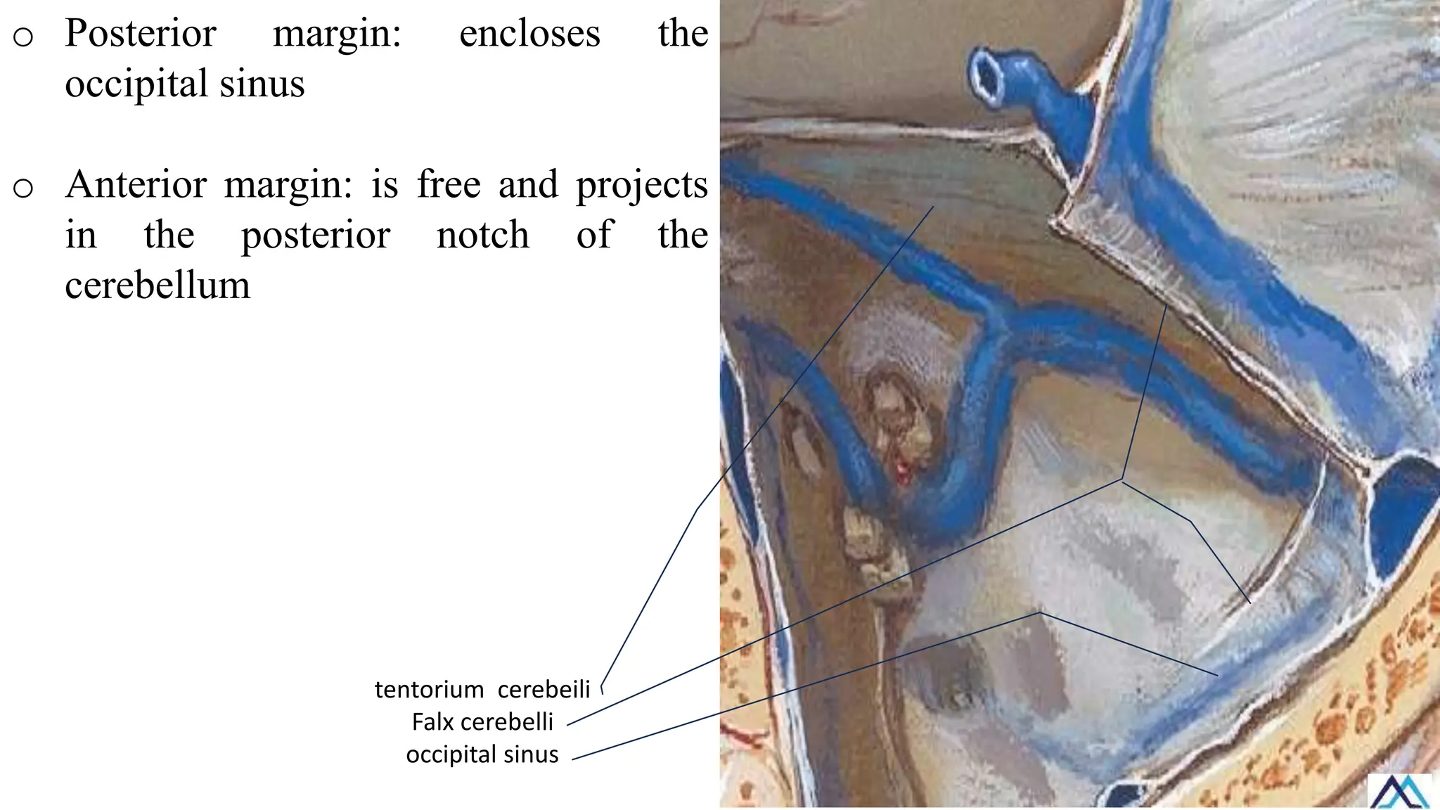 o Posterior margin: encloses the
occipital sinus
o Anterior margin: is free and projects
in the posterior notch of the
cerebellum
tentorium cerebeili
Falx cerebelli
occipital sinus
 