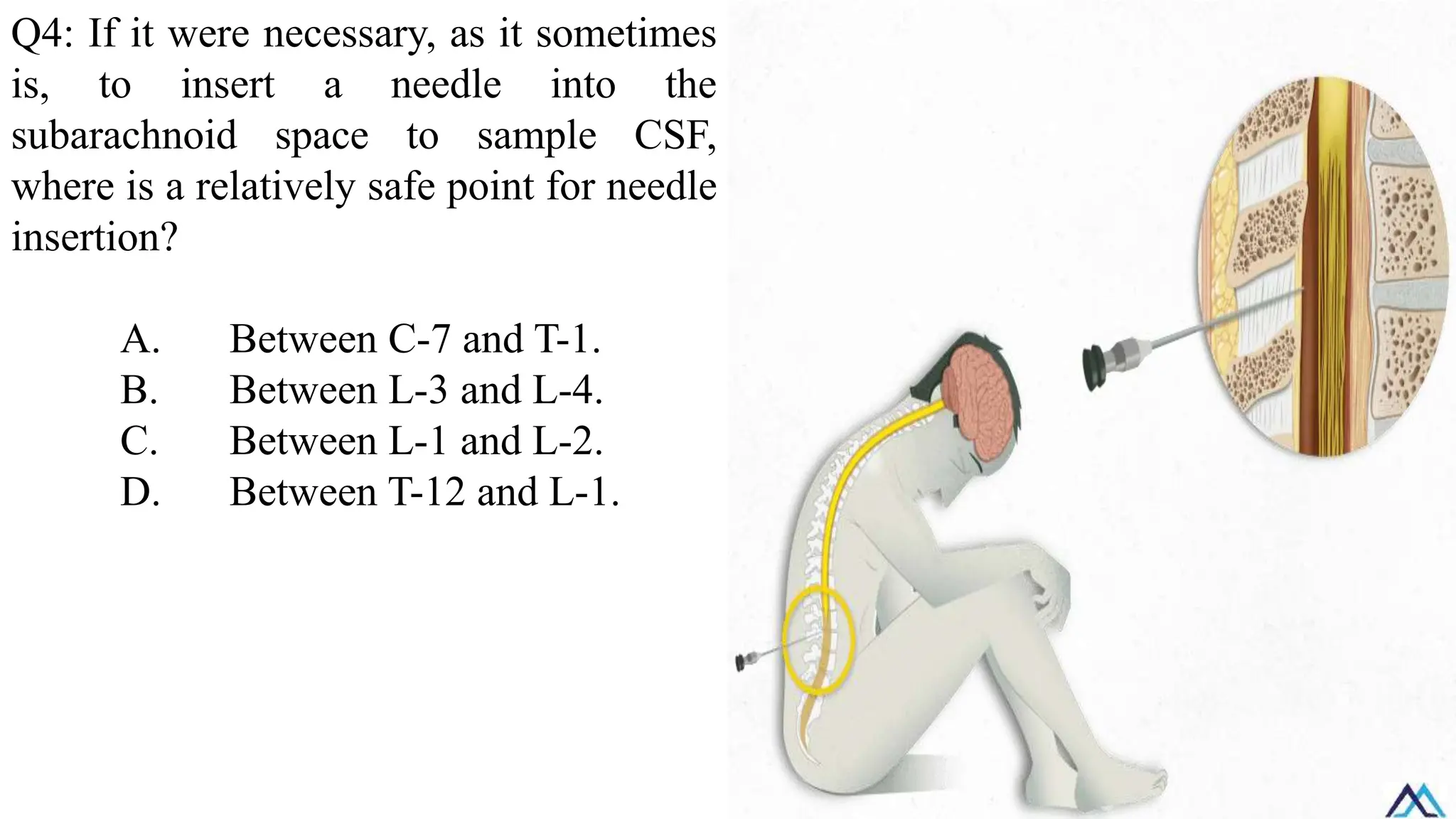 Q4: If it were necessary, as it sometimes
is, to insert a needle into the
subarachnoid space to sample CSF,
where is a relatively safe point for needle
insertion?
A. Between C-7 and T-1.
B. Between L-3 and L-4.
C. Between L-1 and L-2.
D. Between T-12 and L-1.
 