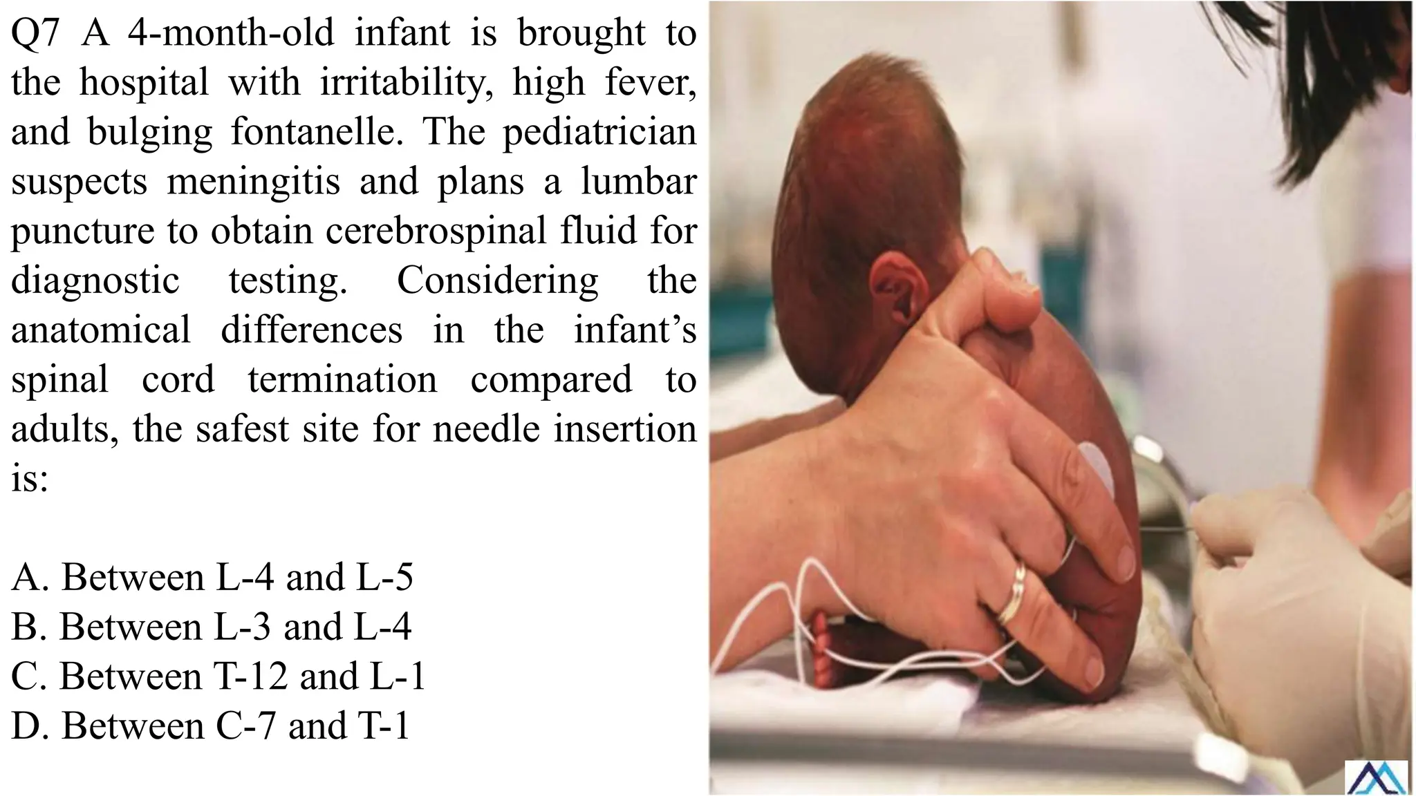 Q7 A 4-month-old infant is brought to
the hospital with irritability, high fever,
and bulging fontanelle. The pediatrician
suspects meningitis and plans a lumbar
puncture to obtain cerebrospinal fluid for
diagnostic testing. Considering the
anatomical differences in the infant’s
spinal cord termination compared to
adults, the safest site for needle insertion
is:
A. Between L-4 and L-5
B. Between L-3 and L-4
C. Between T-12 and L-1
D. Between C-7 and T-1
 