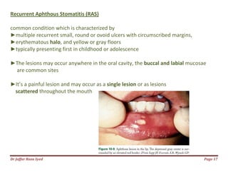 Major Ras 021.acute gingival diseases | PDF