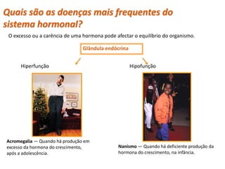 Quais são as doenças mais frequentes do
sistema hormonal?
 O excesso ou a carência de uma hormona pode afectar o equilíbrio do organismo.

                                Glândula endócrina


      Hiperfunção                                    Hipofunção




Acromegalia — Quando há produção em
excesso da hormona do crescimento,            Nanismo — Quando há deficiente produção da
após a adolescência.                          hormona do crescimento, na infância.

  Planeta Terra — 9.º ano
 
