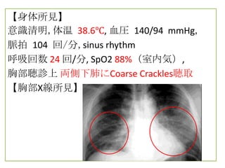 【身体所見】
意識清明,体温 38.6℃, 血圧 140/94 mmHg,
脈拍 104 回/分,sinus rhythm
呼吸回数 24 回/分, SpO2 88%（室内気）,
胸部聴診上 両側下肺にCoarse Crackles聴取
【胸部X線所見】
 