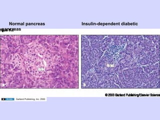02.18.09: Review: Type 1 Diabetes and Overview of Immune Response | PDF