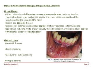 Dr Jaffar Raza Syed
Diseases Clinically Presenting As Desquamative Gingivitis
Lichen Planus
Lichen planus is an inflmmatory mucocutaneous disorder
mucosal surfaces (e.g., oral cavity, genital tract, and
skin (including the scalp and the
occurs as a bilateral disease
presence of cutaneous violaceous
appears as radiating white or gray
‘Wickham’s striae’ or ‘Honiton Lace’
Gingival types
Keratotic lesions:
Erosive lesions:
Vesicular or bullous lesions:
Atropic lesions:
lly Presenting As Desquamative Gingivitis
inflmmatory mucocutaneous disorder that may involve
mucosal surfaces (e.g., oral cavity, genital tract, and other mucosae) and the
skin (including the scalp and the nails)
presence of cutaneous violaceous papules that may coalesce to form plaques
appears as radiating white or gray-velvety thread like lesion, which consists of papules
Honiton Lace’
Page 9
may involve
other mucosae) and the
that may coalesce to form plaques
velvety thread like lesion, which consists of papules
 