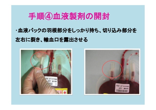 輸血 手順 輸血 細胞治療参考資料