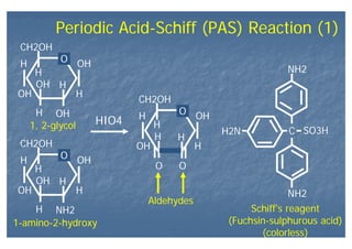 Periodic Acid-Schiff (PAS) Reaction (1)
CH2OH
O OH
HOH
H
H
H
OH
OH
H
CH2OH
O OH
HOH
H
H
H
NH2
OH
H
CH2OH
O OH
HOH
H
H
H
O
H
O
HIO4
H2N C SO3H
NH2
NH2
1, 2-glycol
1-amino-2-hydroxy
Aldehydes
Schiff’s reagent
(Fuchsin-sulphurous acid)
(colorless)
 