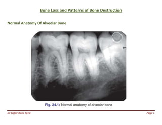 Dr Jaffar Raza Syed
Bone Loss and Patterns of Bone Destruction
Normal Anatomy Of Alveolar Bone
Bone Loss and Patterns of Bone Destruction
Normal Anatomy Of Alveolar Bone
Page 1
Bone Loss and Patterns of Bone Destruction
 