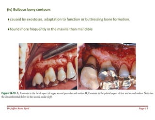 Dr Jaffar Raza Syed
(iv) Bulbous bony contours
caused by exostoses, adaptation
found more frequently in the maxilla than mandible
caused by exostoses, adaptation to function or buttressing bone formation.
more frequently in the maxilla than mandible
Page 11
to function or buttressing bone formation.
 