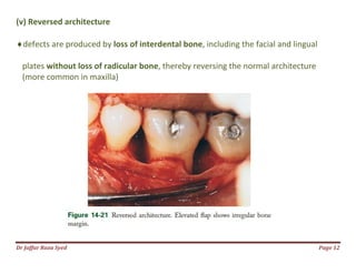 Dr Jaffar Raza Syed
(v) Reversed architecture
defects are produced by loss of interdental bone
plates without loss of radicular bone
(more common in maxilla)
loss of interdental bone, including the facial and lingual
without loss of radicular bone, thereby reversing the normal
Page 12
including the facial and lingual
, thereby reversing the normal architecture
 