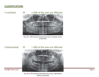 Dr Jaffar Raza Syed
CLASSIFICATION
• Localized  ≤ 30% of the sites are affected
• Generalized  > 30% of the sites are affected
≤ 30% of the sites are affected
> 30% of the sites are affected
Page 2
 