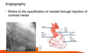 Angiography
- Refers to the opacification of vessels through injection of
contrast media
 