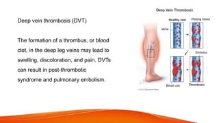 Deep vein thrombosis (DVT)
The formation of a thrombus, or blood
clot, in the deep leg veins may lead to
swelling, discoloration, and pain. DVTs
can result in post-thrombotic
syndrome and pulmonary embolism.
 