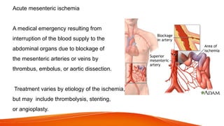 Acute mesenteric ischemia
A medical emergency resulting from
interruption of the blood supply to the
abdominal organs due to blockage of
the mesenteric arteries or veins by
thrombus, embolus, or aortic dissection.
Treatment varies by etiology of the ischemia,
but may include thrombolysis, stenting,
or angioplasty.
 